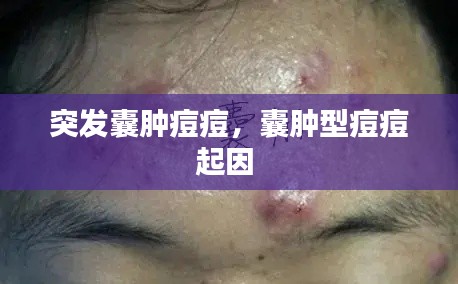 突发囊肿痘痘，囊肿型痘痘起因 